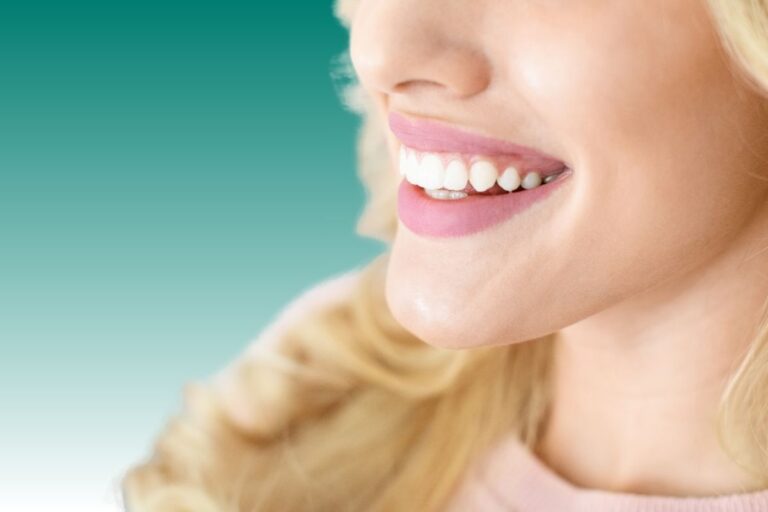 E-Max Veneers near me