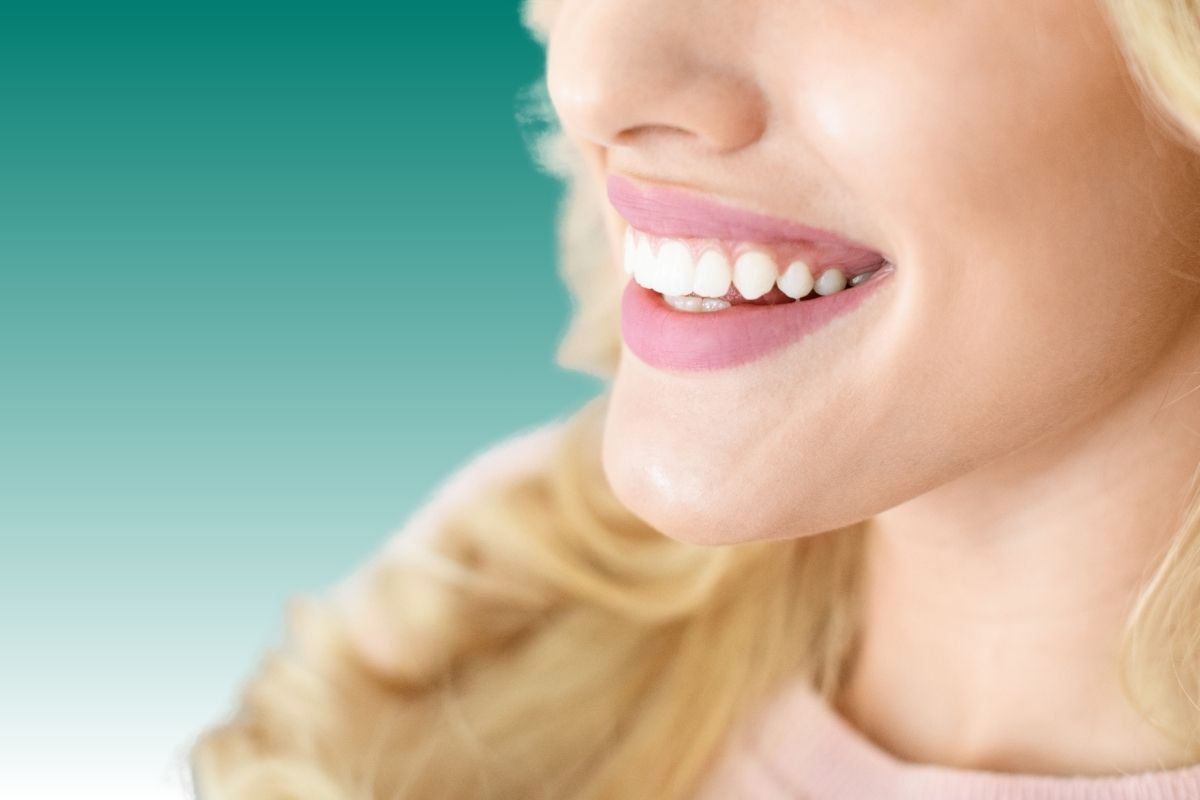 E-Max Veneers near me