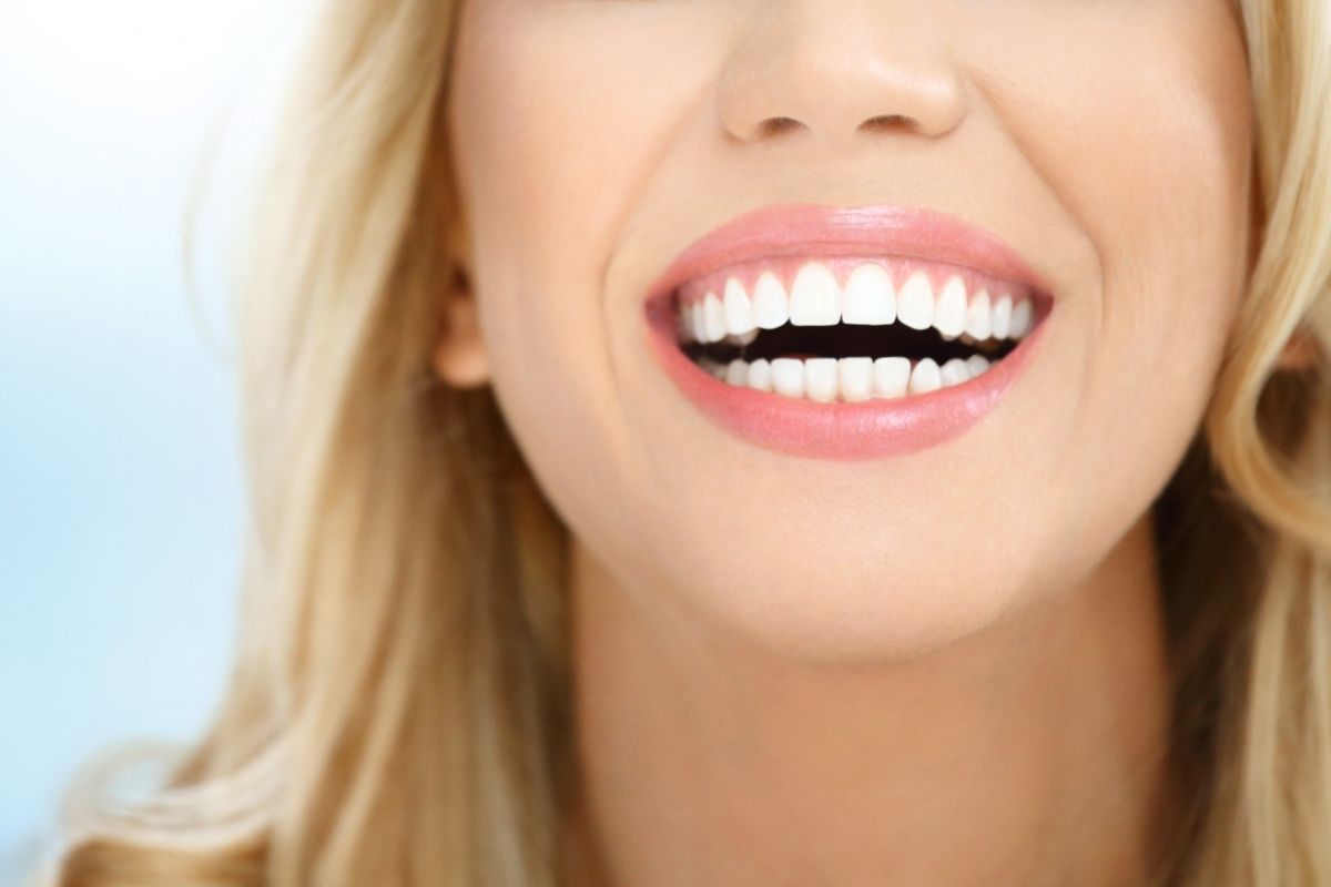 Hollywood Smile in Antalya